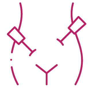 procedure image