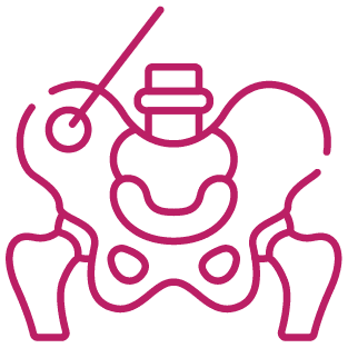 procedure image