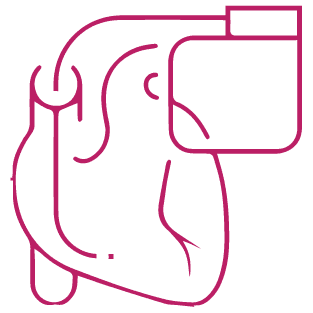 procedure image